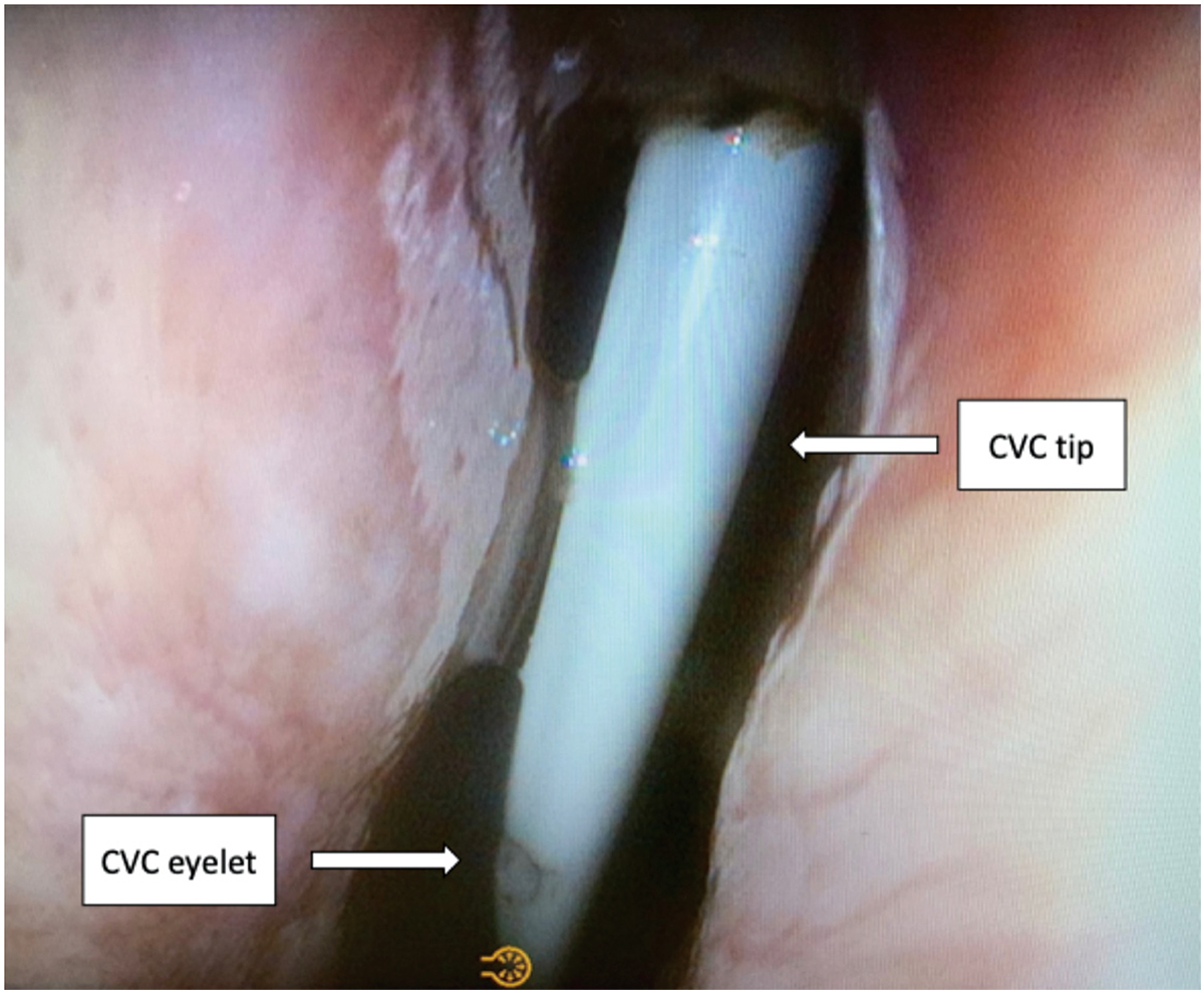 Figure 2.